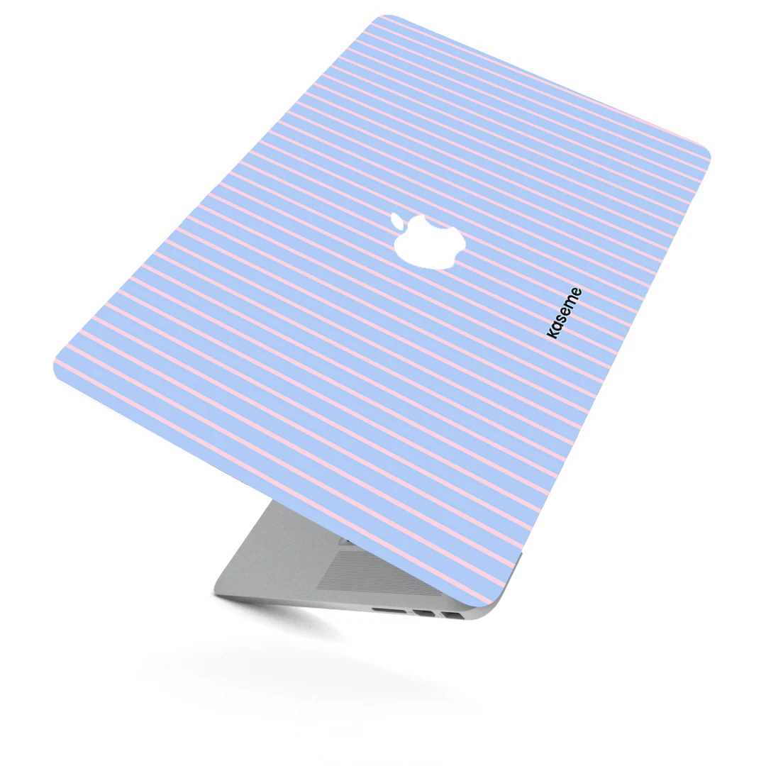 Dolce Striscia Blue MacBook Skin - Image 3